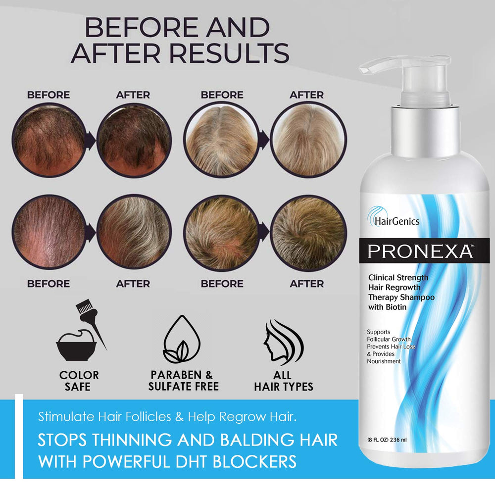 Pronexa: imagen de aplicación diaria en cabello para mejor manejo