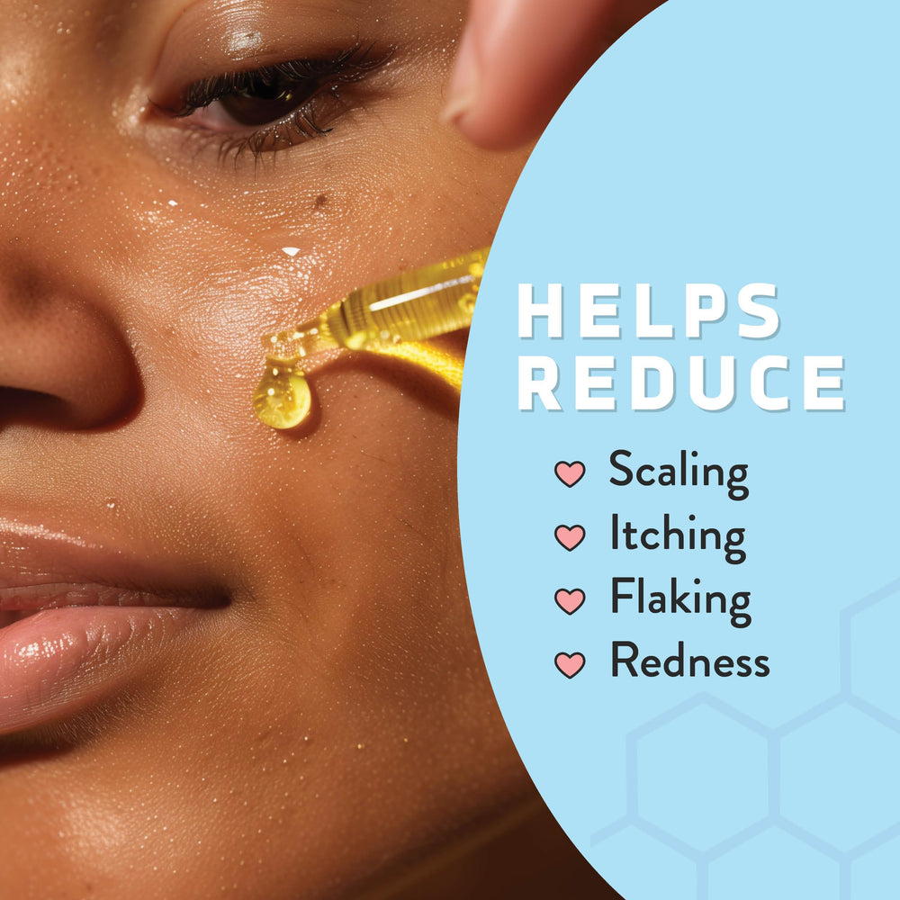 PSORIASIS HONEY hidratación diaria para piel y cuerpo, sensación ligera