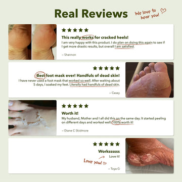 Purederm pasos de cuidado para pies, guía para una rutina cotidiana