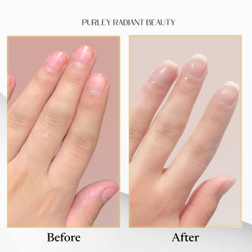 Apto para todo tipo de uñas, incluso tras recuperación de tratamientos.