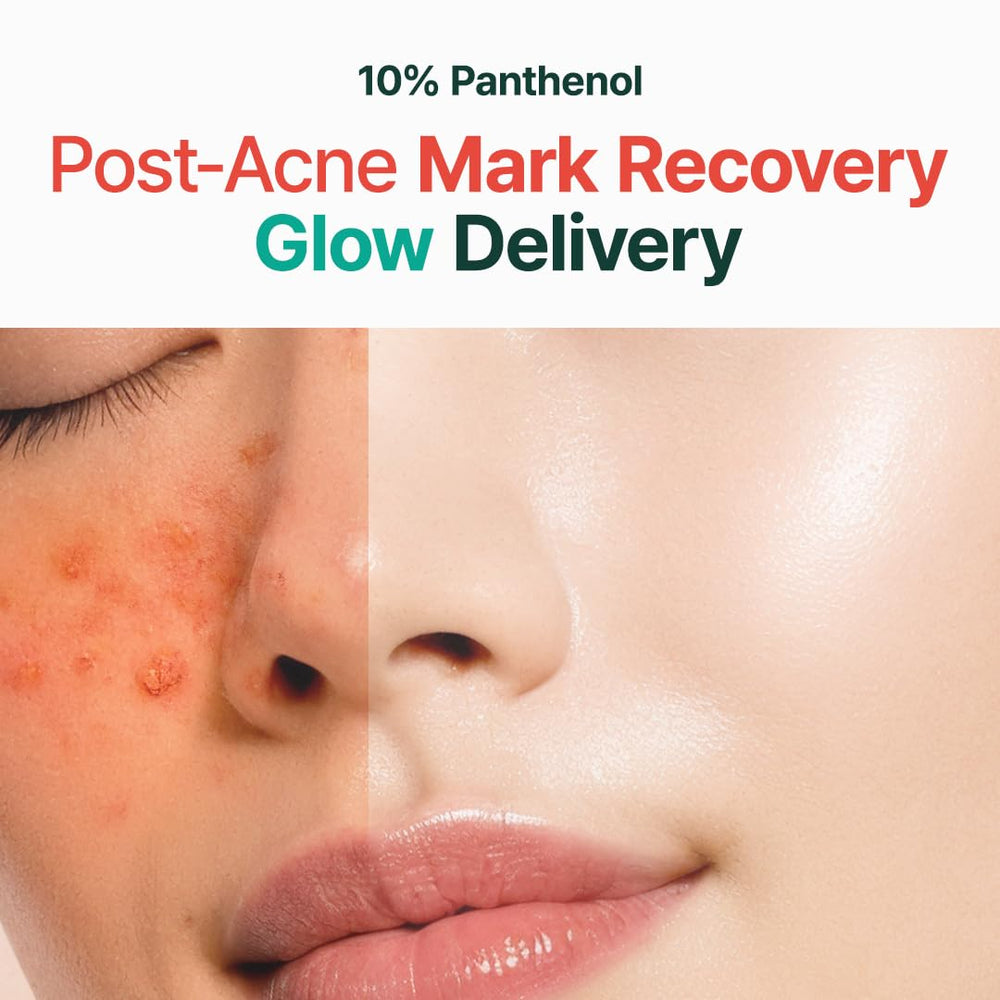 Purito Panthenol 10% post‑acné, textura cremosa lista para aplicar.