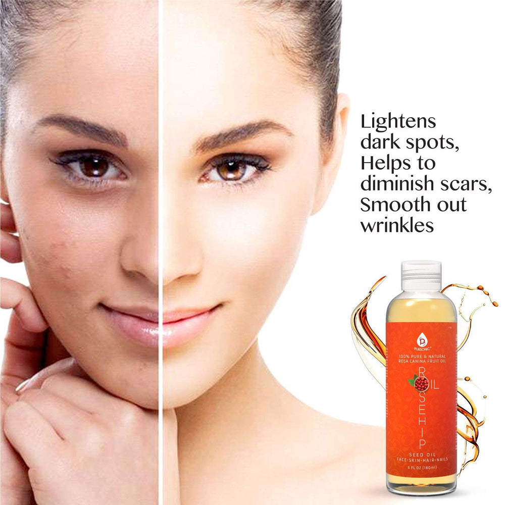 Cuidado de uñas y cabello con Pursonic Rosa Mosqueta