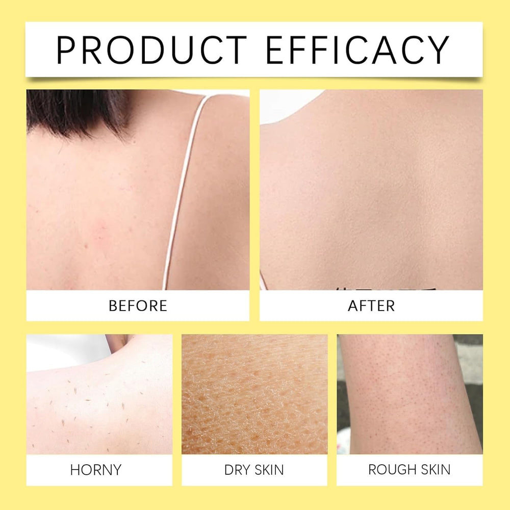Pwkvsn Peel Shot Keratin, cuidado corporal exfoliante: mejora la textura de piel.