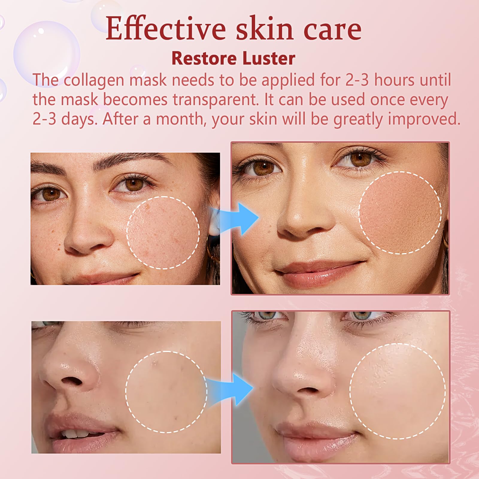 Qawnfy Bio-Collagen fórmula probióticos fortalece la barrera cutánea