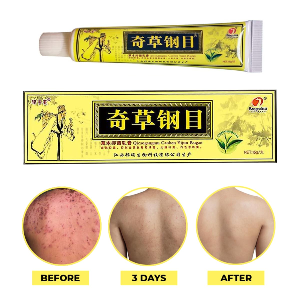 QICAOGANGMU crema herbal China, textura suave, aplicación diaria.