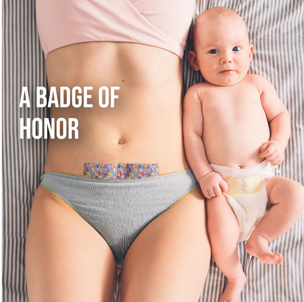Quitch dermatologist-mom designed silicone scar sheets featured in floral packaging.