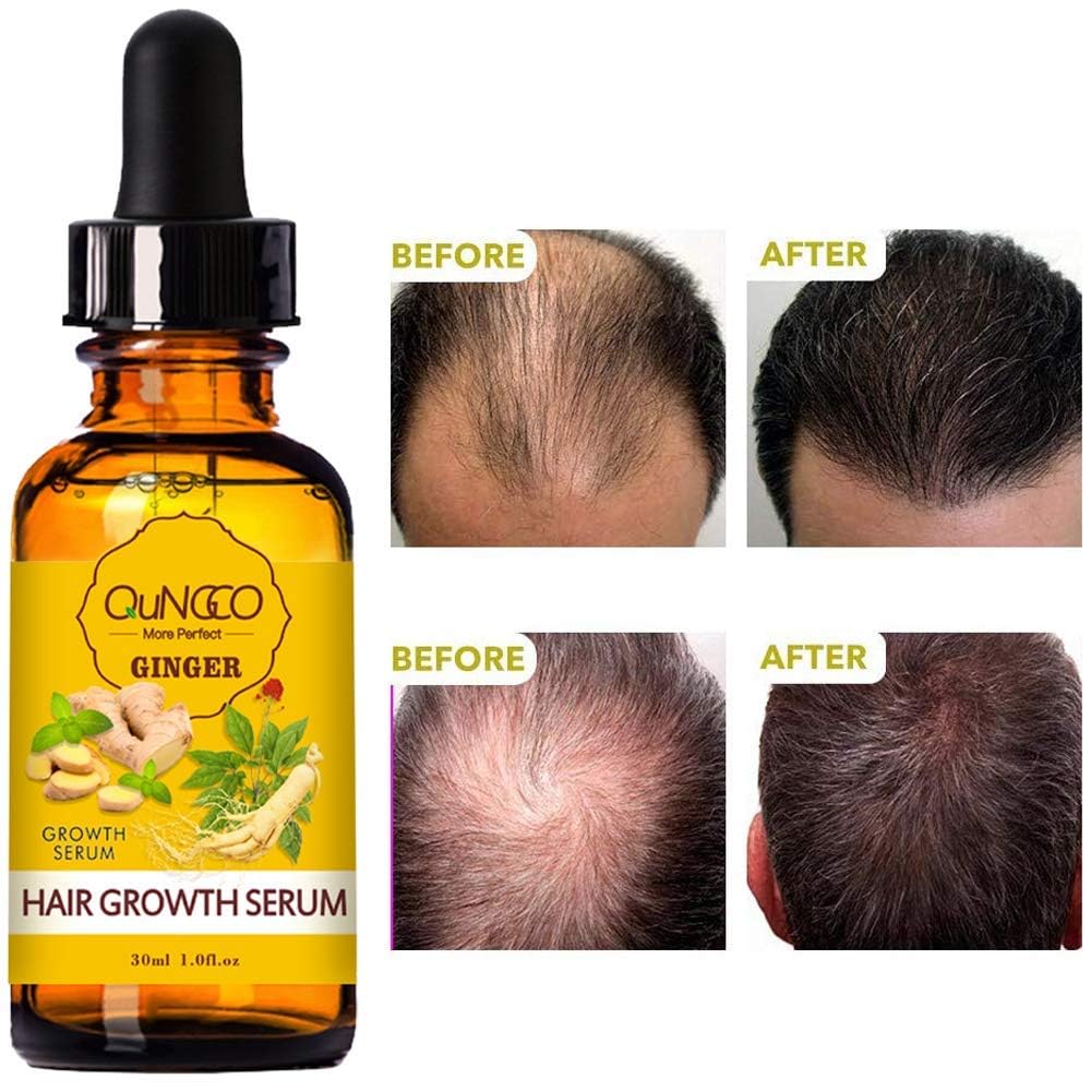 QUNGCO Serum, ingredientes-naturales que nutren el cuero cabelludo