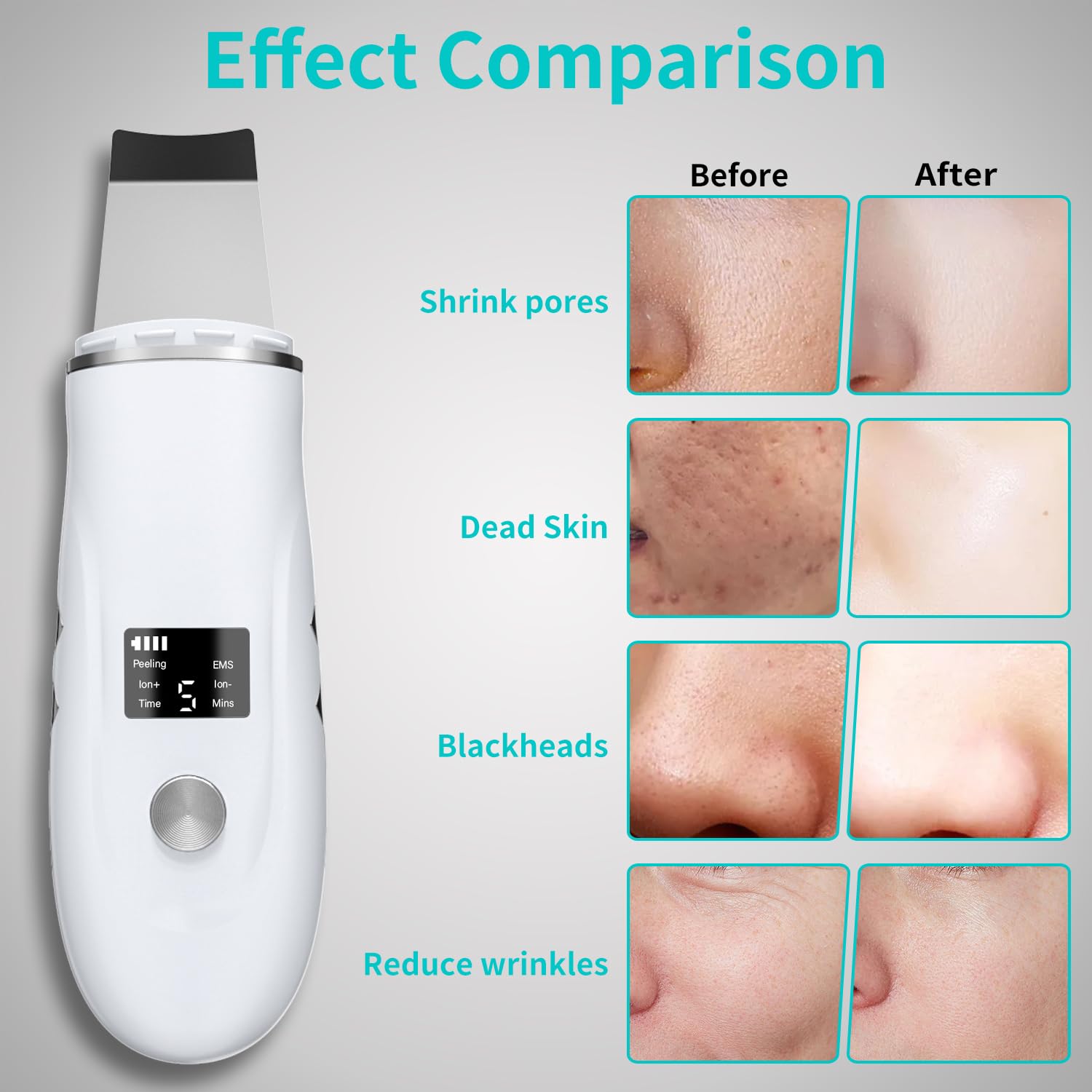 QYCSL espátula facial con base de carga dual para uso cómodo