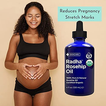 Radha Beauty Aceite rosa mosqueta para cabello, hidrata y aporta brillo sin pesadez
