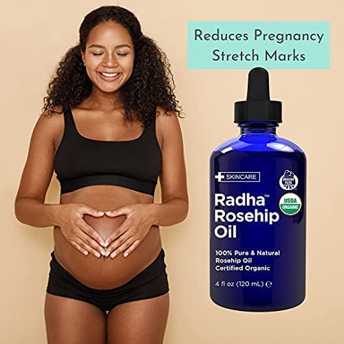 Radha Beauty Aceite rosa mosqueta para cabello, hidrata y aporta brillo sin pesadez