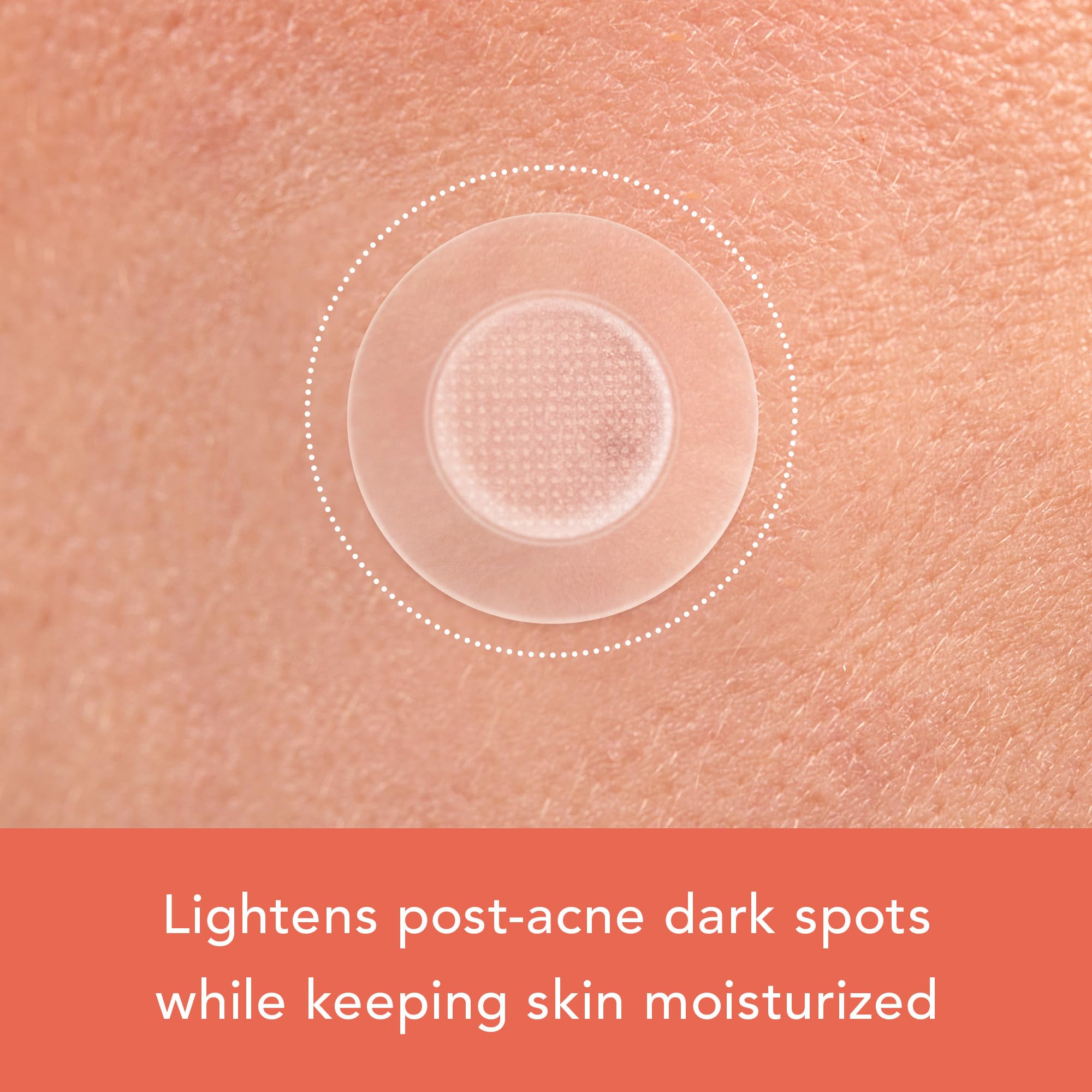 Rael Pimple Patches containing Niacinamide and Glutathione support brighter-looking skin.