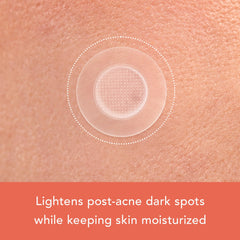 Rael Pimple Patches containing Niacinamide and Glutathione support brighter-looking skin.