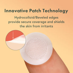 Rael Pimple Patches with 10% Vitamin C targets uneven skin tone.