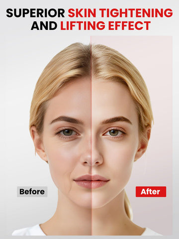 Thérapie lumineuse rouge sur le visage, stimulation du teint possible.