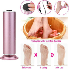 Conjunto de discos lijado 60 piezas para personalizar exfoliación suave o intensa.