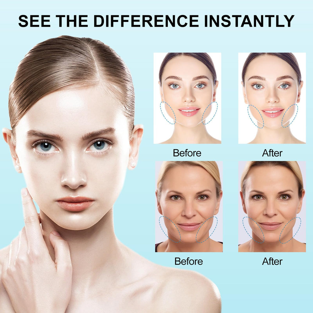 Redcool cinta de levantamiento facial para ojos y mandíbula con adherencia estable