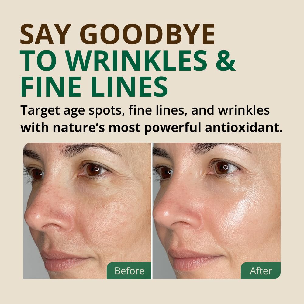 Aceite de oliva RejuveNaturals para piel sensible e hidratación diaria.