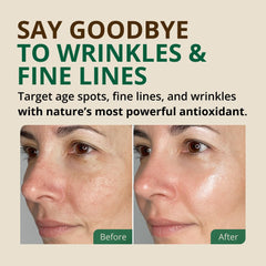 Aceite de oliva RejuveNaturals para piel sensible e hidratación diaria.