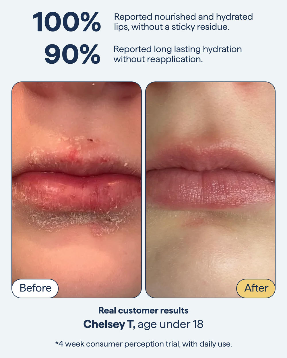Remedy Science esqualano bálsamo labial para hidratación duradera
