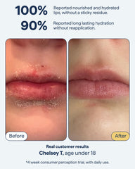 Remedy Science esqualano bálsamo labial para hidratación duradera