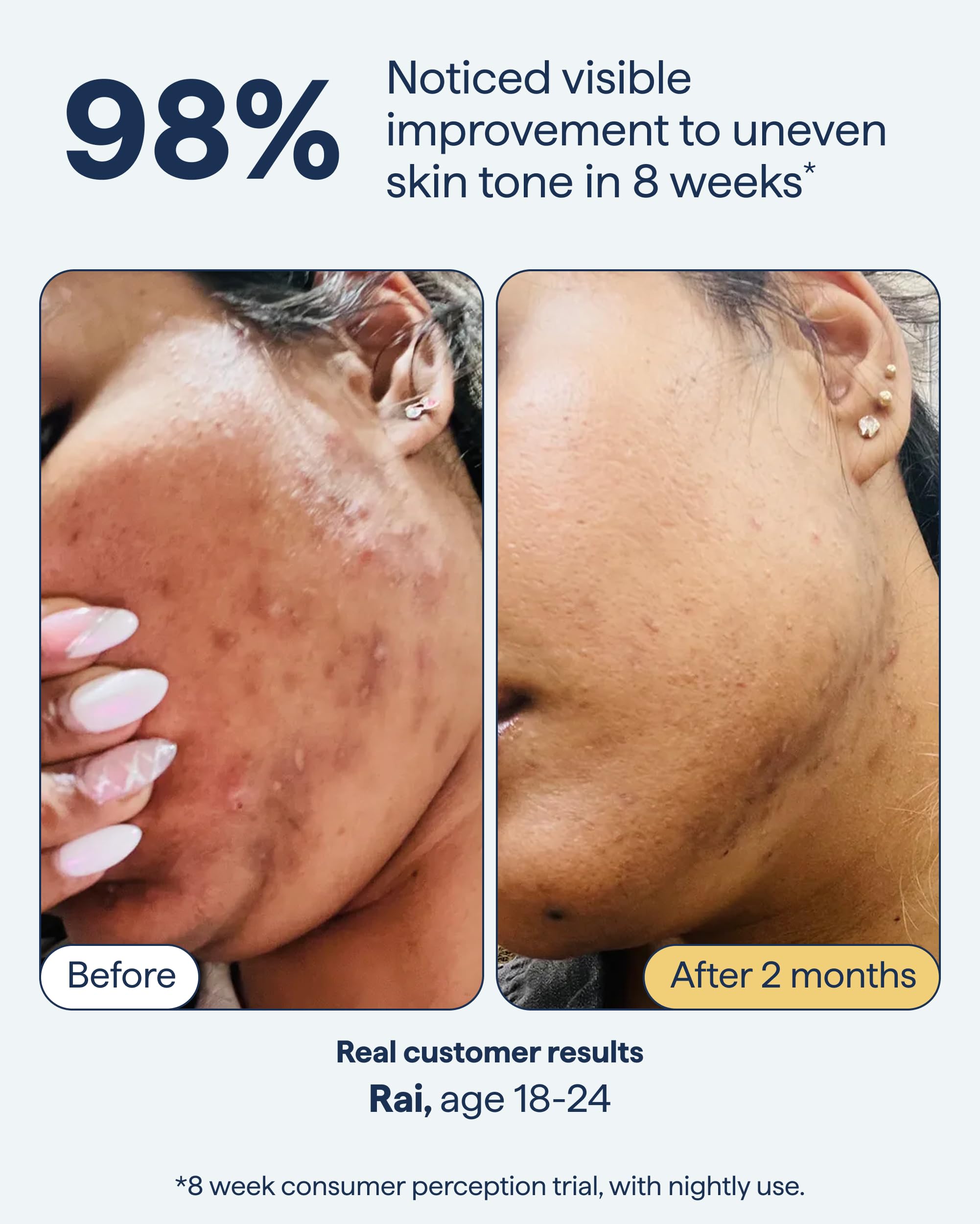 Remedy Science Kojic Acid — aide contre les taches pigmentaires
