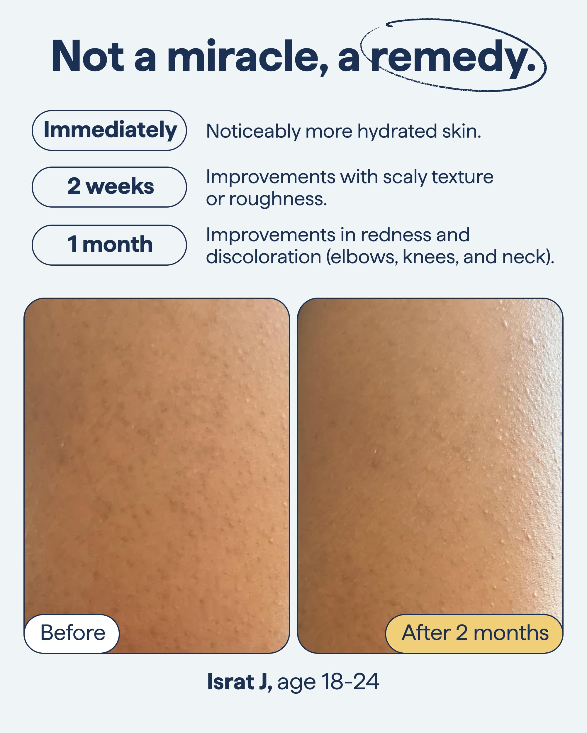 Remedy Science crema con retinol encapsulado, cuidado corporal
