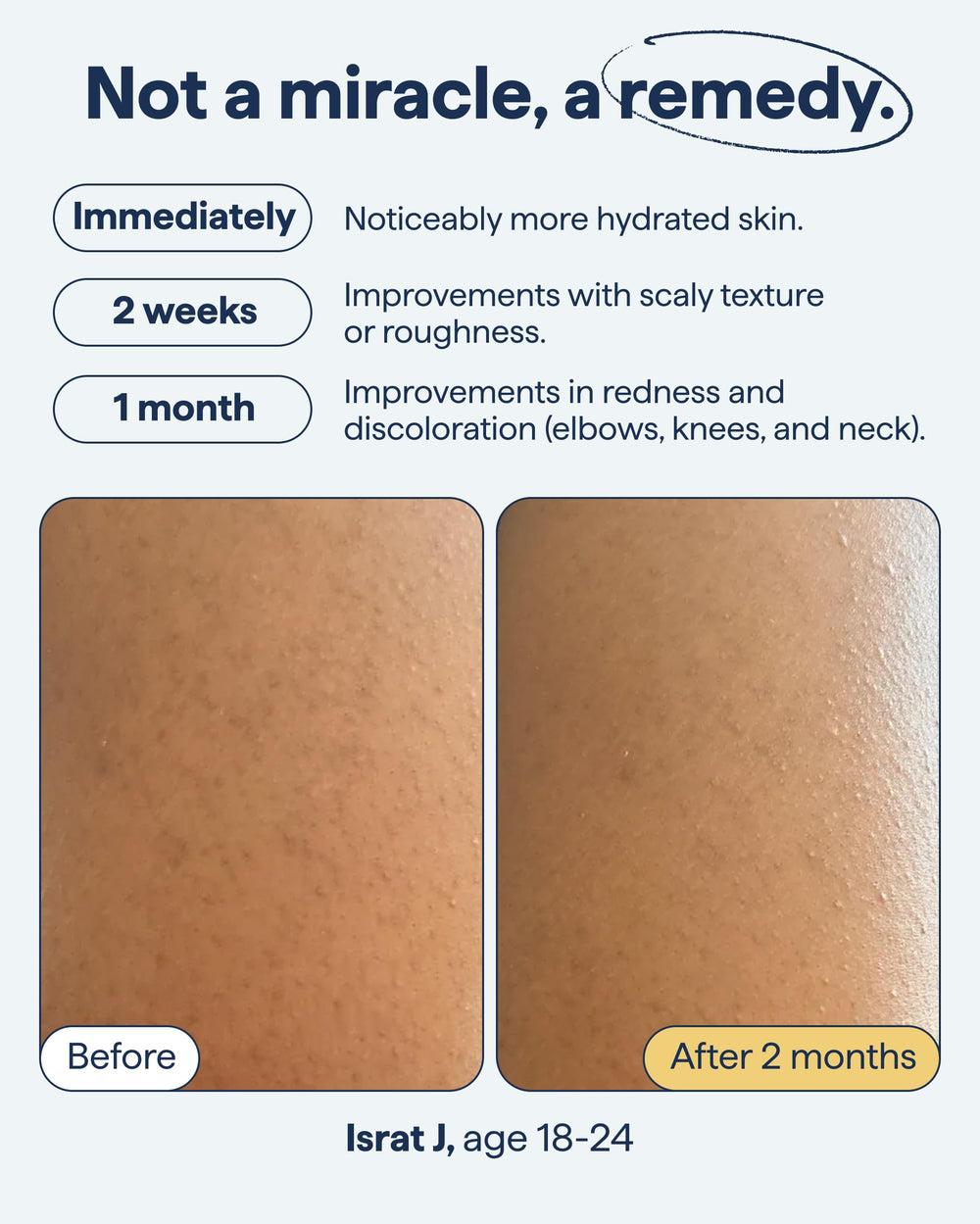 Remedy Science crema con retinol encapsulado, cuidado corporal