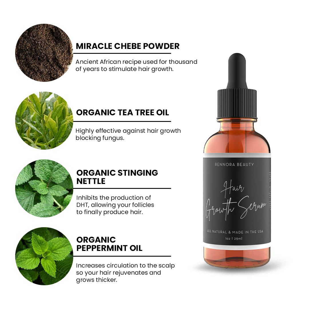 Huile d'ortie Rennora – bienfaits potentiels pour les cheveux.