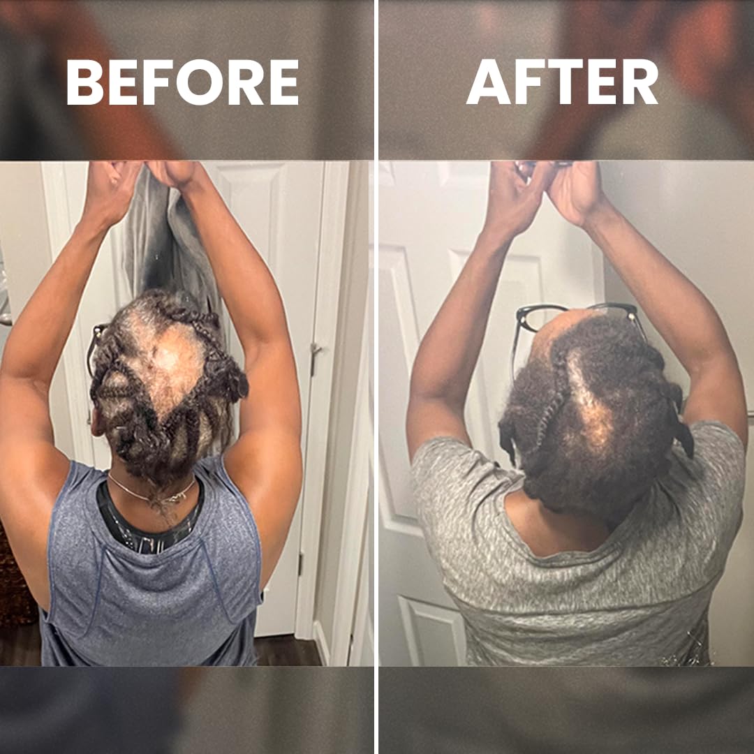 Rennora sérum textura suave que se absorbe fácilmente.