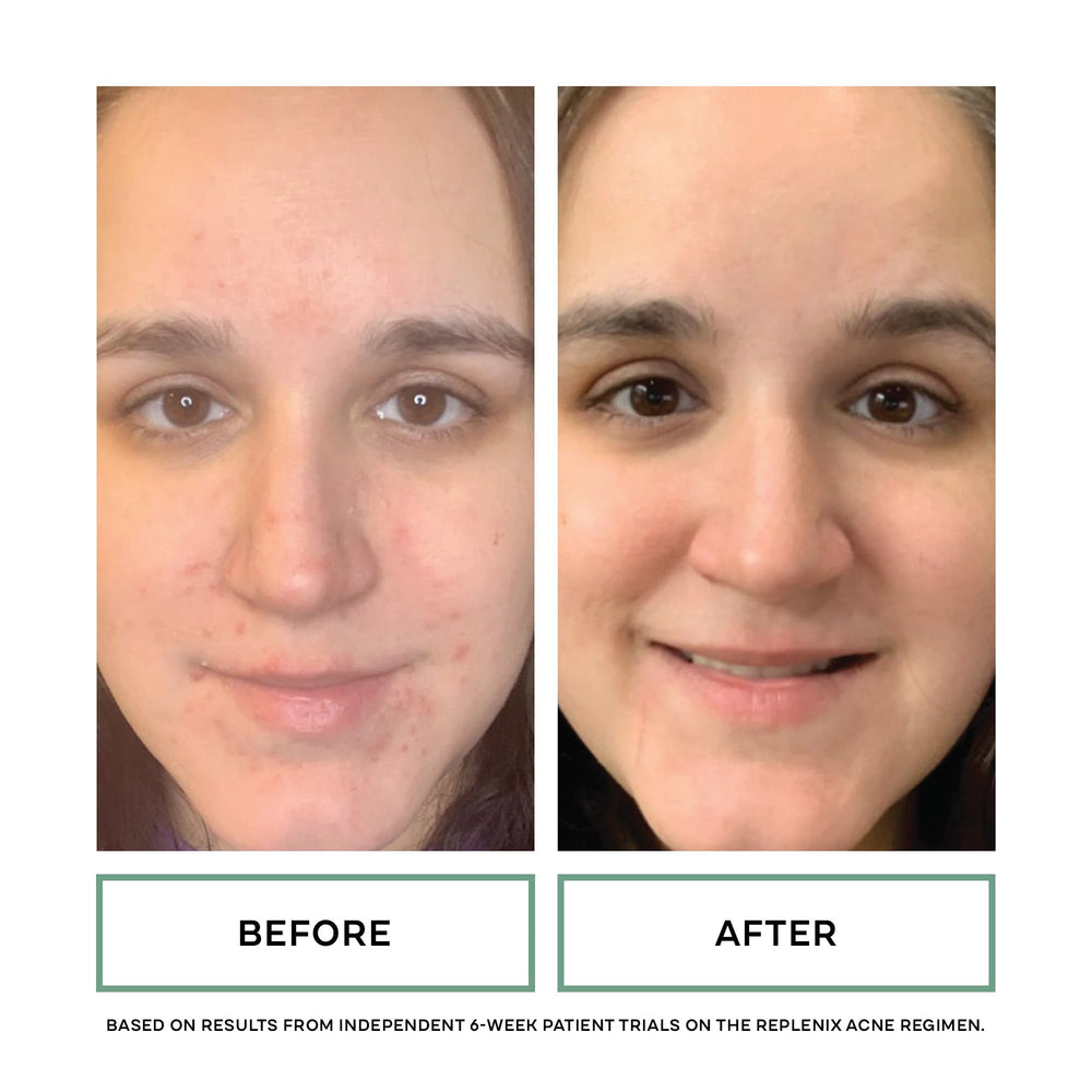 Replenix aplicación en manos para limpieza suave del rostro.