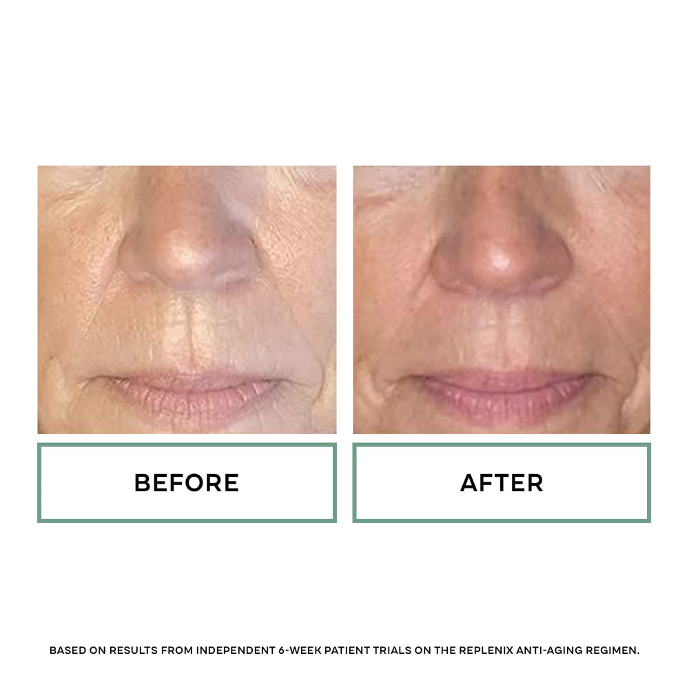 Replenix crema glicólico 20% ofrece antioxidantes que protegen la barrera.