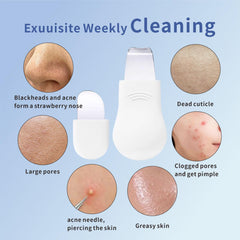 REVEX espátula facial concava ideal para extracción suave