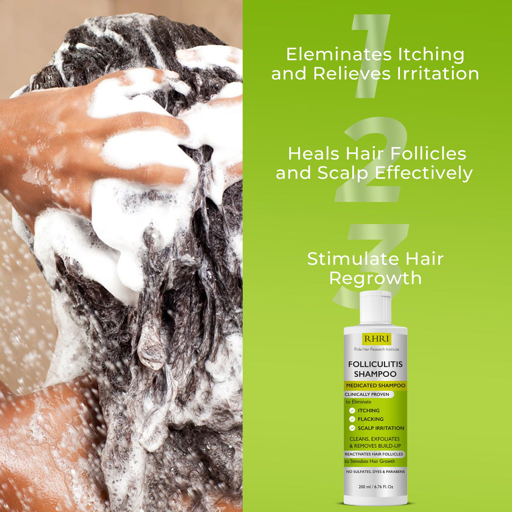 Rida Hair Research Institute anti-fungal shampoo on scalp treatment concept image.