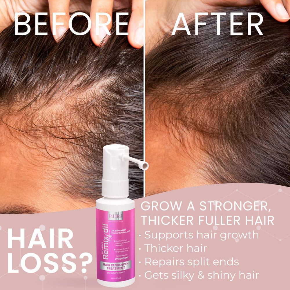 Rida Hair Minoxidil bottle and hair strands illustrating potential regrowth support.