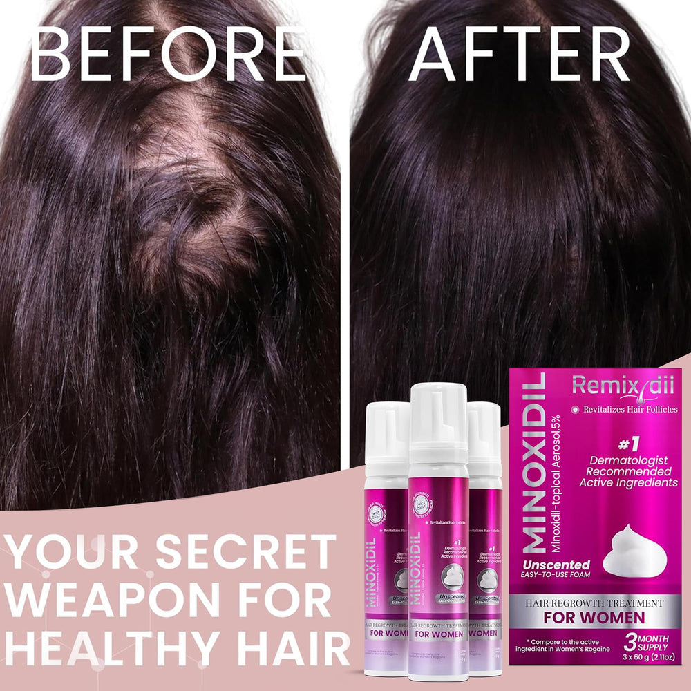 Minoxidil de Rida Hair: resultados visibles con aplicación constante