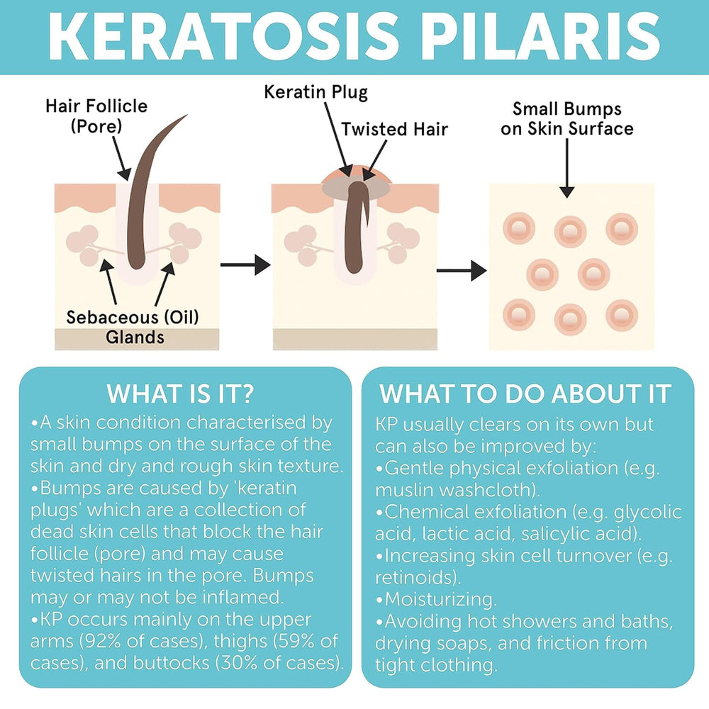 Conjunto KP Bump Eraser para piel sin bultos y piernas lisas