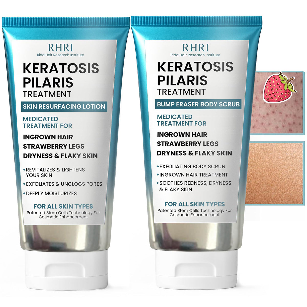 KP Bump Eraser Exfoliante corporal para piel suave, textura agradable