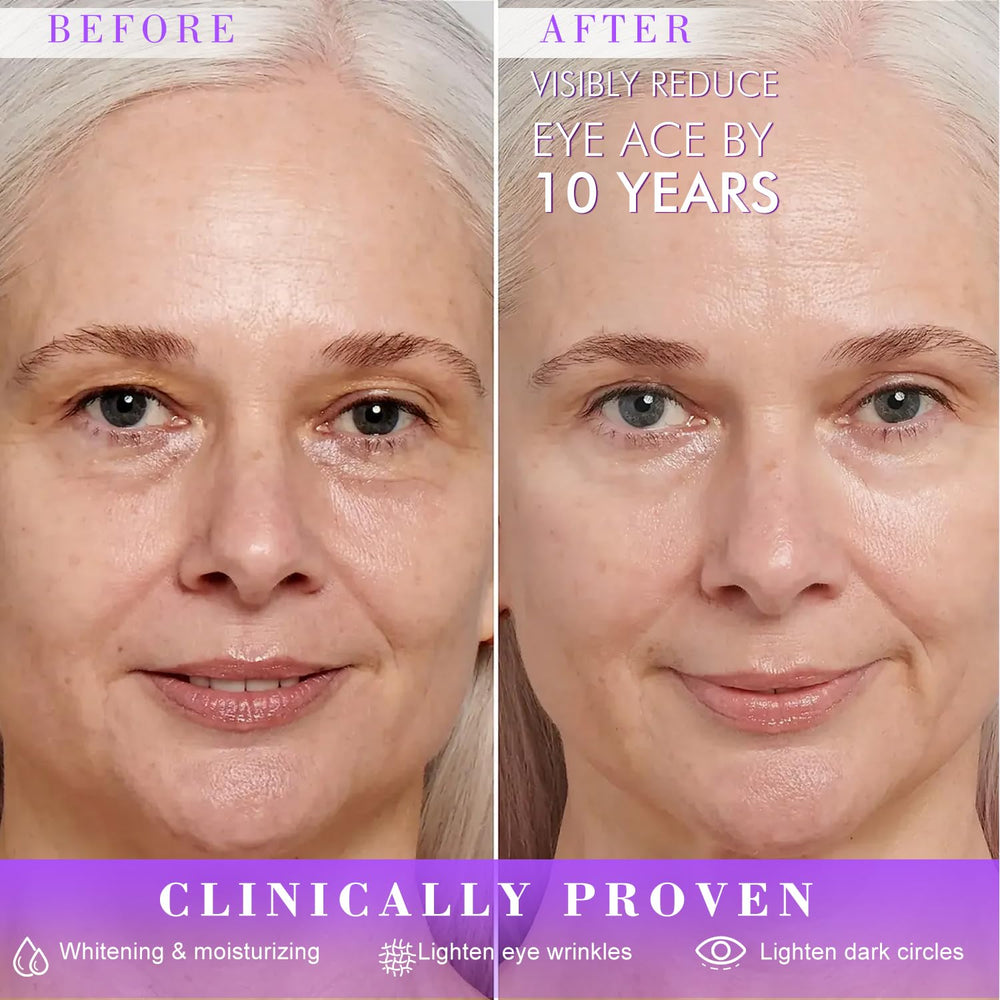 RIGBOO Eye Cream helps with puffiness for refreshed-looking eyes
