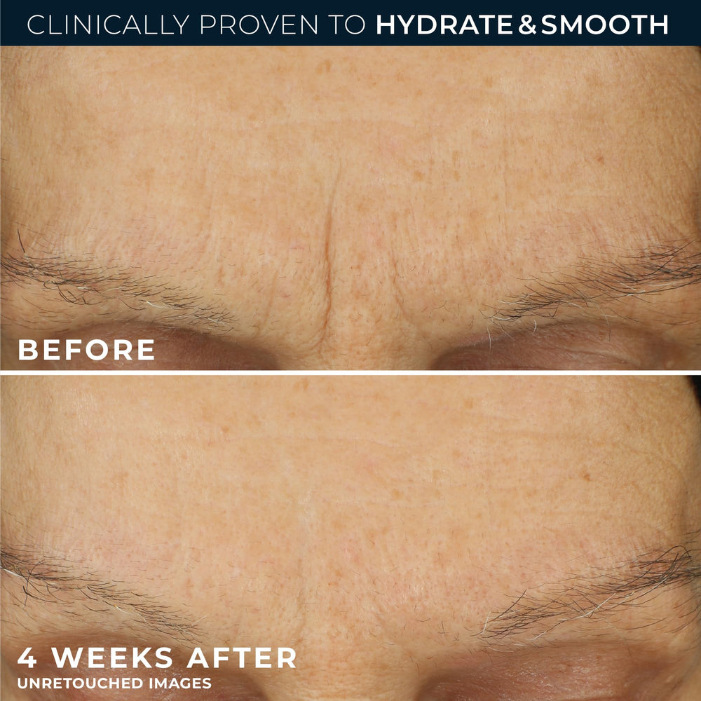 RoC Retinol Correxion Max — taches pigmentaires en réduction avec douceur