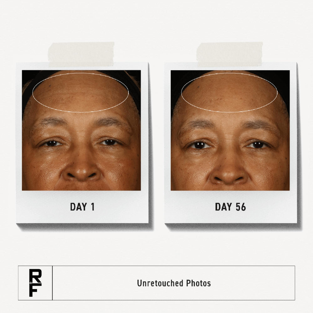 Rodan + Fields Redefine, anti-edad para líneas finas y arrugas.