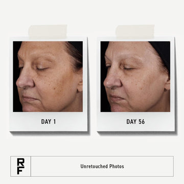 RODAN + FIELDS Reverse Exfoliating Cleanser, piel fresca tras el lavado.