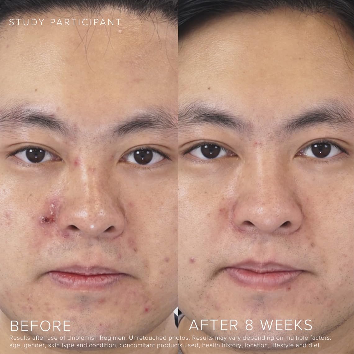 Rodan + Fields Unblemish; ceramidas para mantener la barrera y la suavidad de la piel.