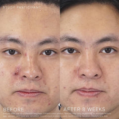 Rodan + Fields Unblemish; ceramidas para mantener la barrera y la suavidad de la piel.