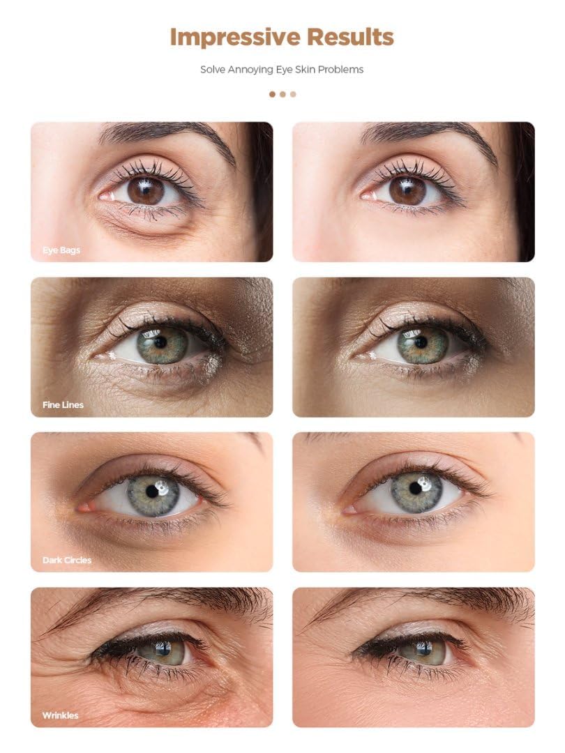 Rokelos parches ojeras extracto de perla: nutrición suave para la piel delicada.