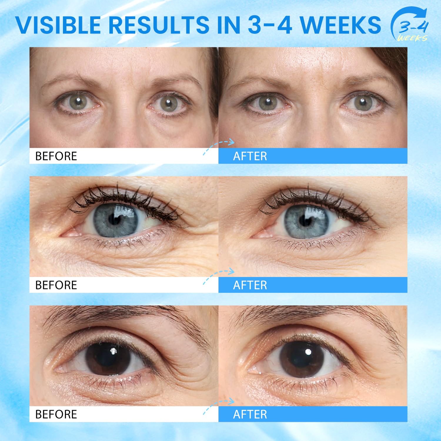 RONKIE Caffeine Eye Stick helps reduce puffiness and under-eye swelling.