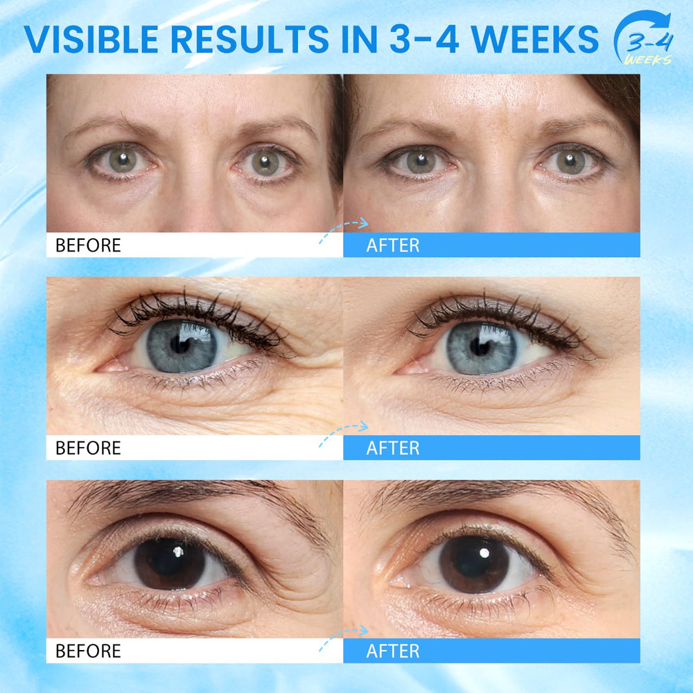 RONKIE Caffeine Eye Stick helps reduce puffiness and under-eye swelling.