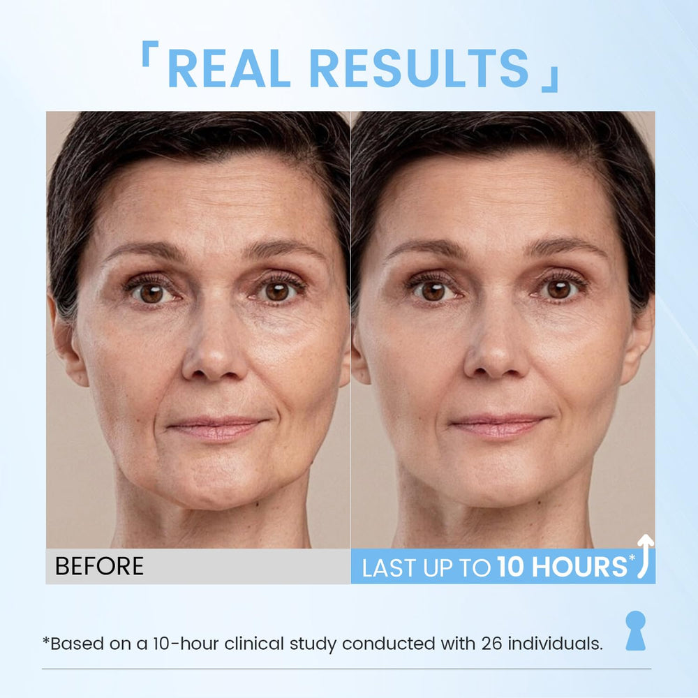 Aplicación suave de la crema de ojos RONKIE alrededor de los ojos