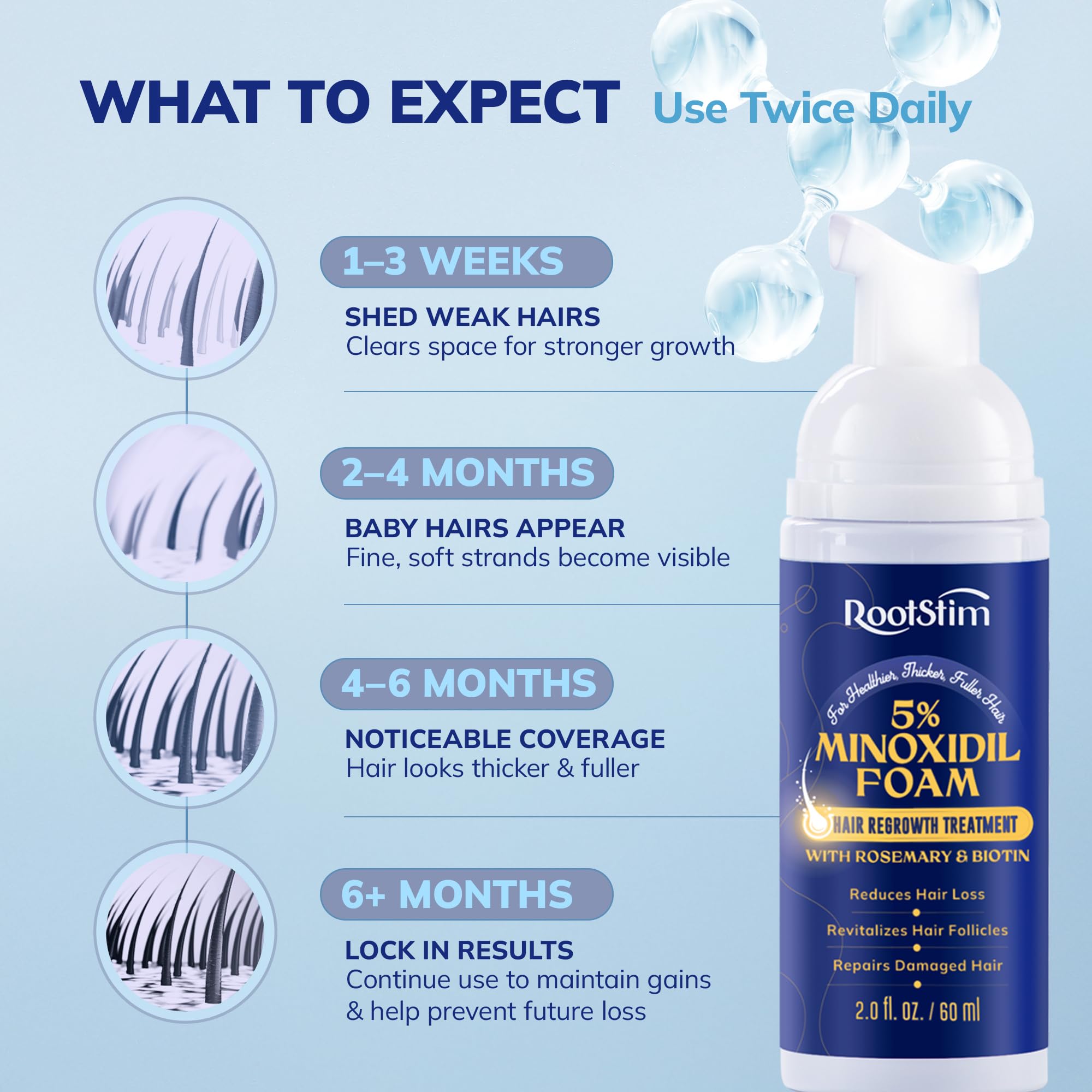 RootStim three-bottle pack for a complete treatment cycle.