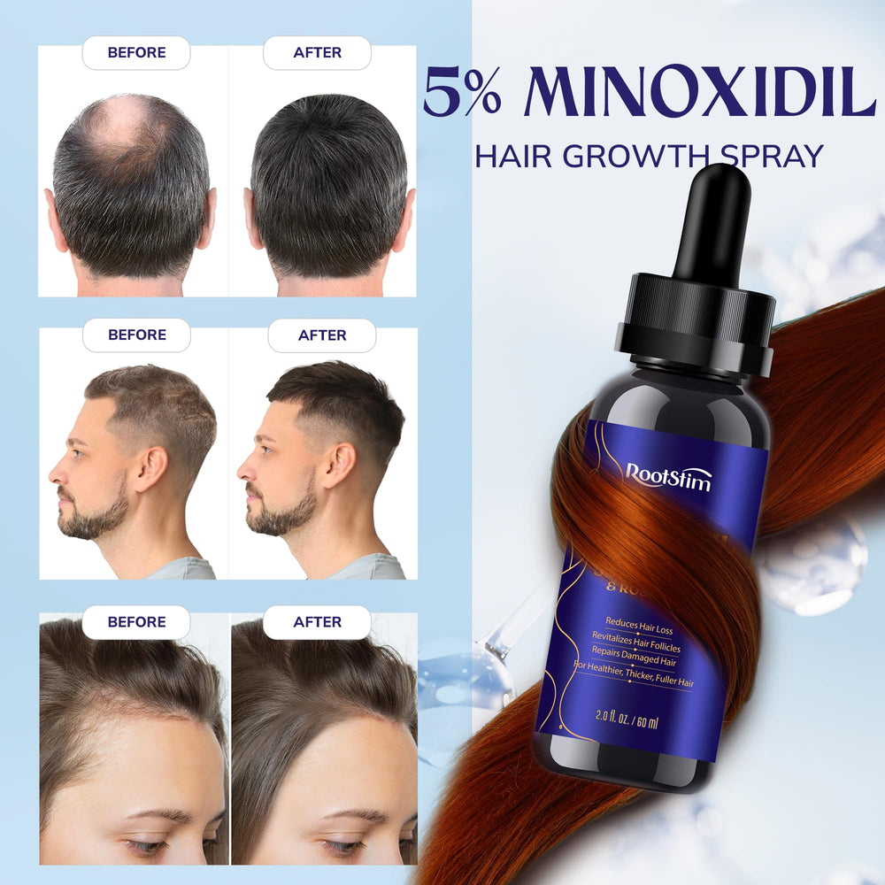 RootStim aplicación precisa para tratamiento localizado en cabello seco.