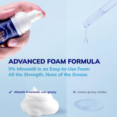 RootStim foam applied to the scalp for targeted thinning support.